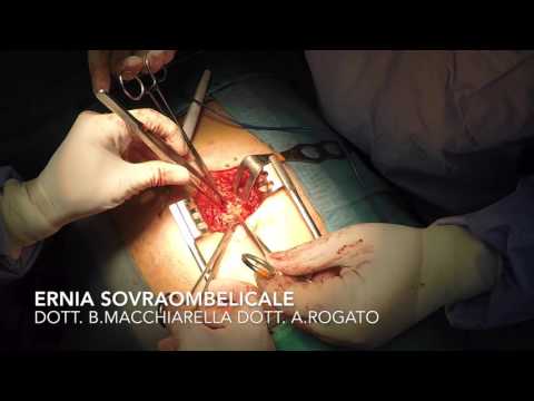 Dolore alla gola durante la deglutizione dà sul retro Polso codice ICD sindrome dellarticolazione