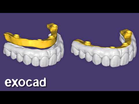 Design Blender Like BARS in EXOCAD
