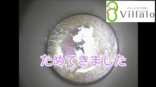 耳掃除動画vol.55「ためてきました」