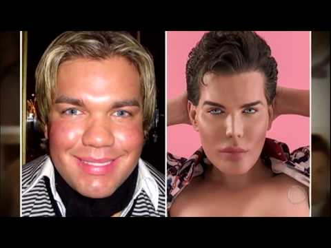 The Brazilian human Ken doll has already undergone more than sixty plastic surgeries.