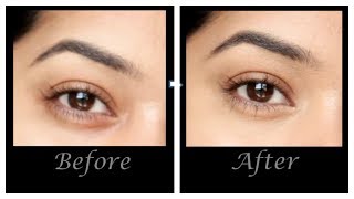 How to conceal under eye dark circles using corrector and concealer..