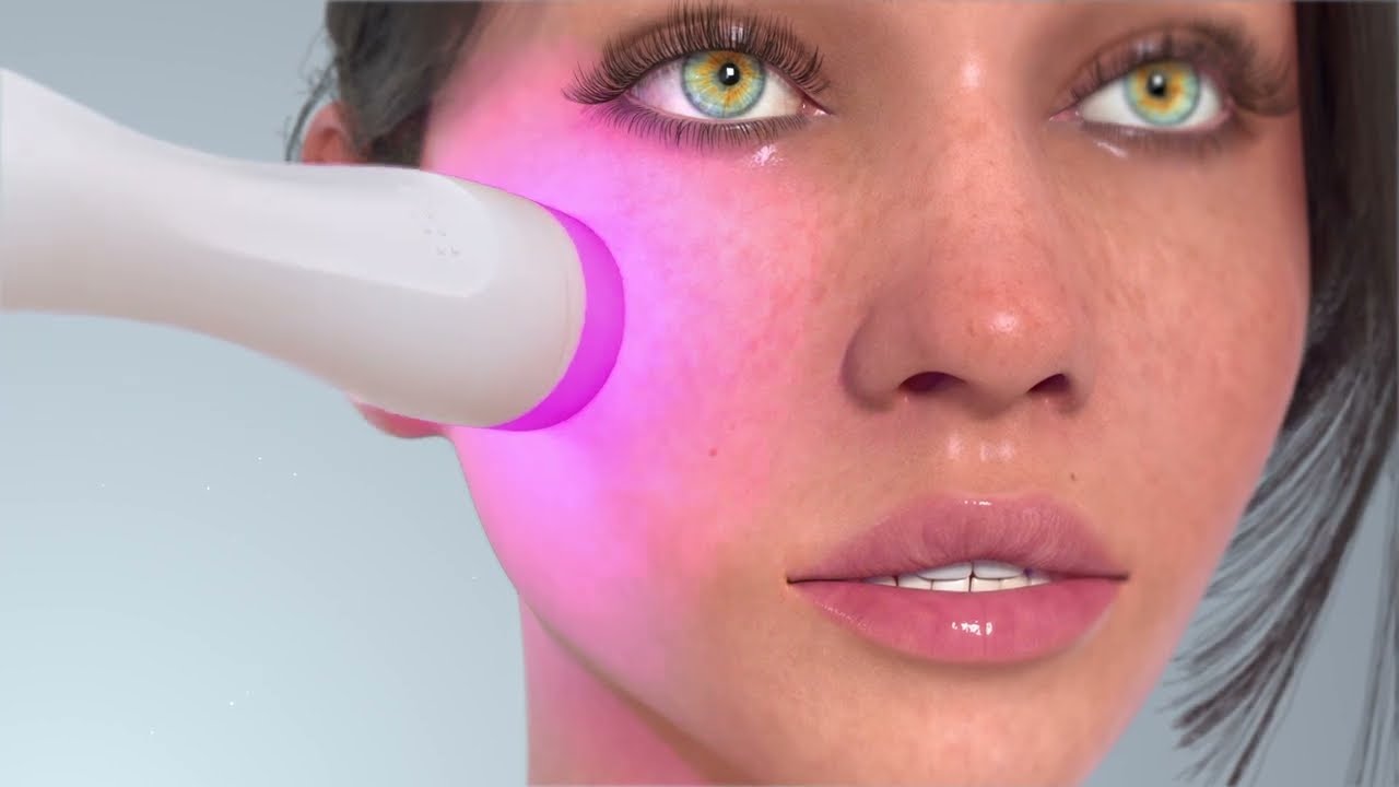 뷰티 디바이스 3D 영상 썸네일