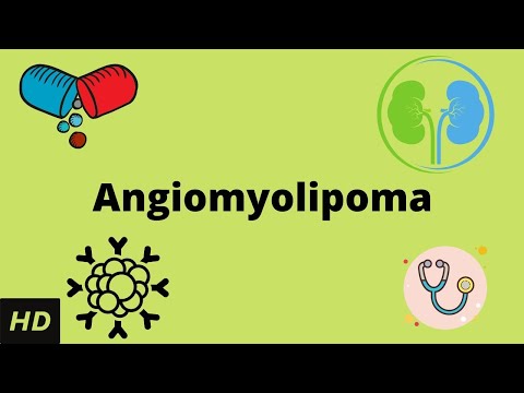 Malignant Peripheral Nerve Sheath Tumor Causes Signs and Symptoms Diagnosis and Treatment