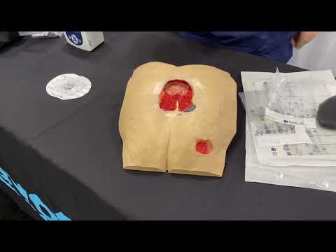 NISUS NPWT PUMP  -  Basic Application