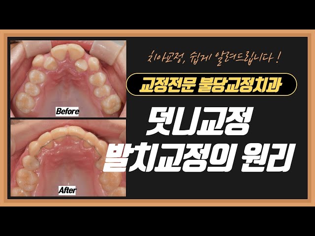 불당교정치과 불당교정치과