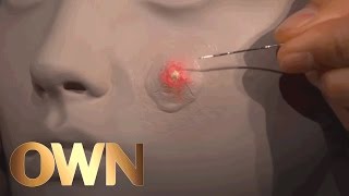 Pimples and How to Pop Them | Ask Oprah's All Stars | Oprah Winfrey Network