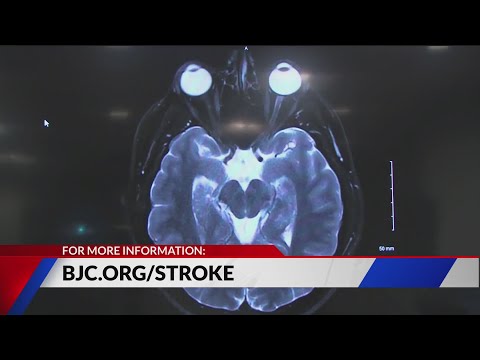 How to reduce your risk of stroke
