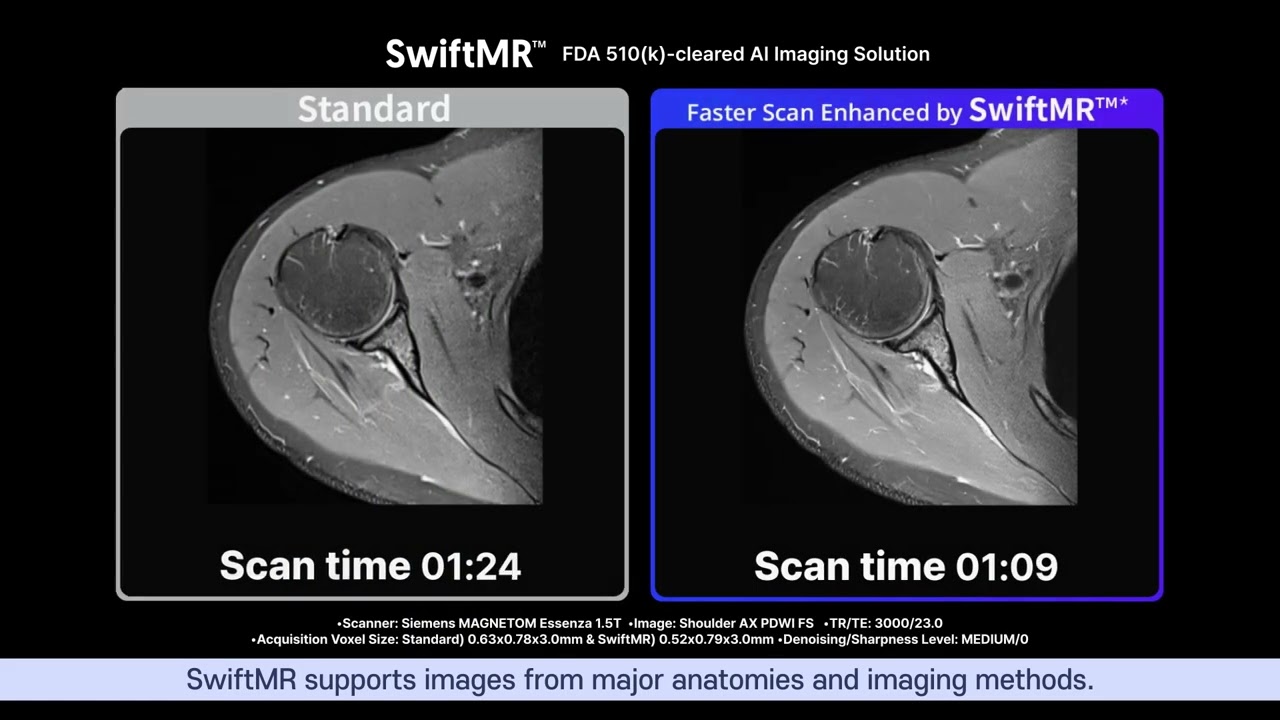 Introduction of SwiftMR / AI MRI Imaging solution by AIRS Medical