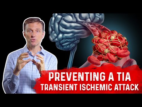 How To Prevent TIA (Transient Ischemic Attack) Mini-Stroke? – Dr.Berg