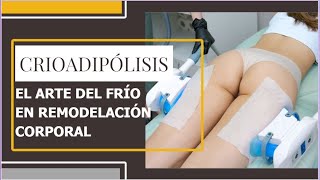 CRIOLIPÓLISIS MÉDICA | CRIOADIPÓLISIS | VILANOVA (Antes y después)