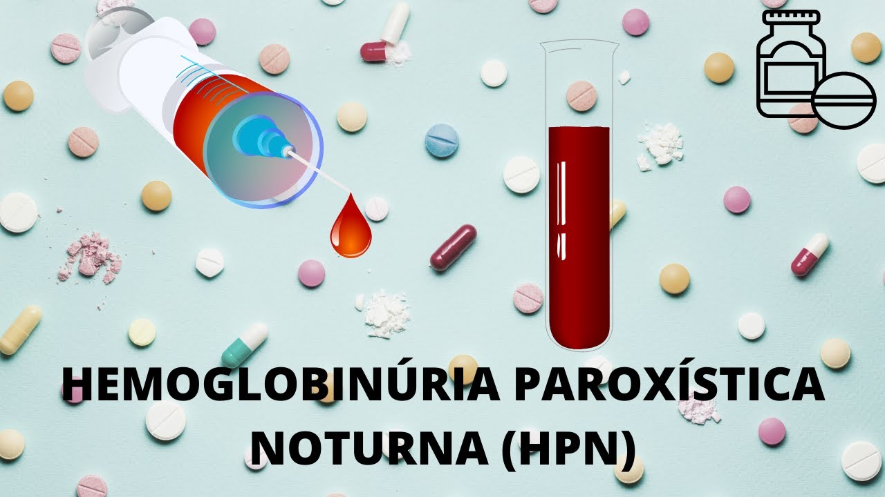 HPN - Hemoglobinúria paroxística noturna.