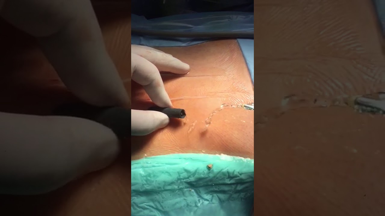 Marcos Meza Salgado-11