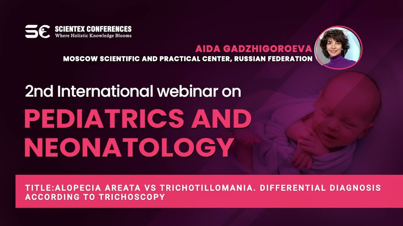 Alopecia areata vs trichotillomania. Differential diagnosis according to trichoscopy