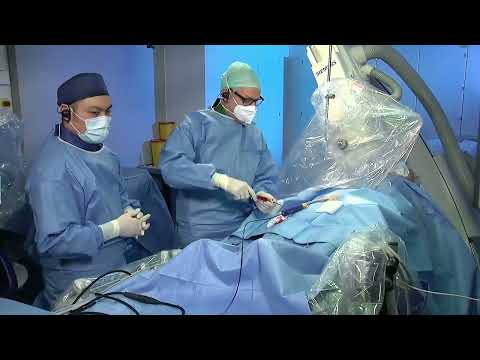 Live Case & Discussion: Pulsed Field Ablation for Pulmonary Veins