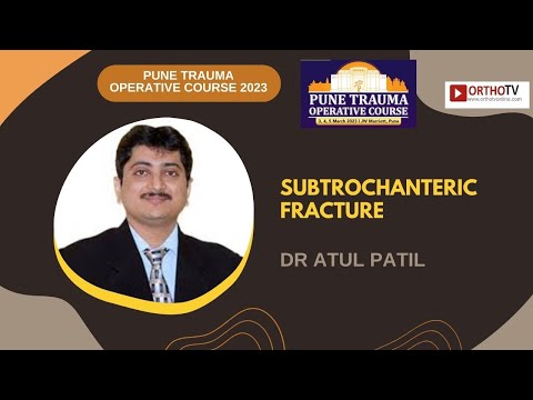 PTOC 2023 : SUBTROCHANTERIC FRACTURE - DR ATUL PATIL