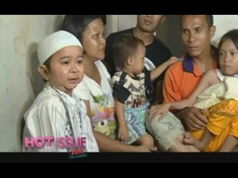 Daus Mini Berempati dengan Salsabila "Anak yang menderita kebocoran jantung"