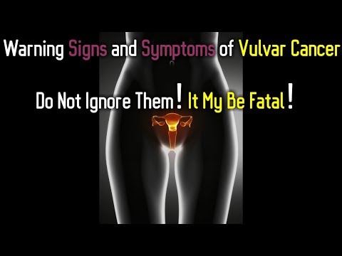 hogyan lehet lefogyni a vulva diy zsírégető