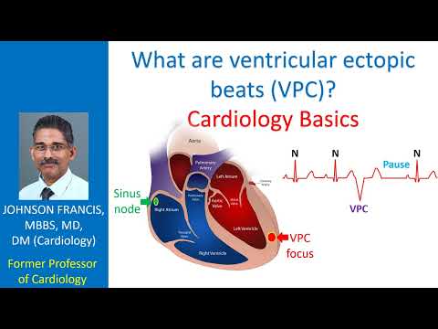 What are ventricular ectopic beats (VPC)? Cardiology Basics