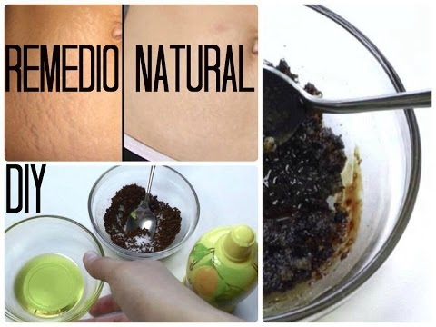 REMEDIO CASERO Y NATURAL PARA LAS ESTRÍAS | MARIEBELLE Video