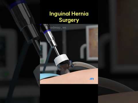 Inguinal Hernia Surgery