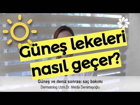 Güneş lekeleri nasıl geçer?