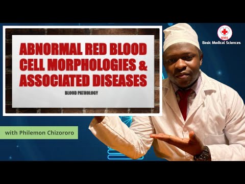 Abnormal RBC morphologies  and associated diseases