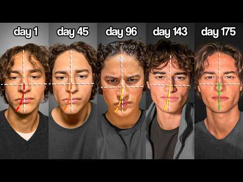 I Spent 175 Days Fixing My Asymmetry | 4-Step Guide
