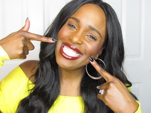 HOW I GET MY TEETH SO WHITE! | THE PRODUCTS I'VE BEEN USING TO WHITEN MY TEETH! | + A SPECIAL GUEST! Video