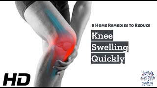 Knee Swelling Begone! 8 Effective Home Remedies You Can Try Today