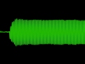 Hospital Beep Pitido Hospital Video And Sound Download Link