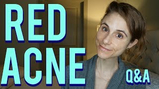 Red acne marks on the face: Q&A with a dermatologist|Dr Dray