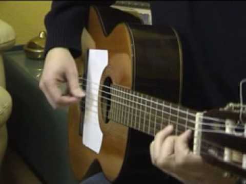 2Flamenco guitarist and dystonia. Distonía focal de la mano