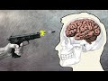 Anatomy Of A Headshot