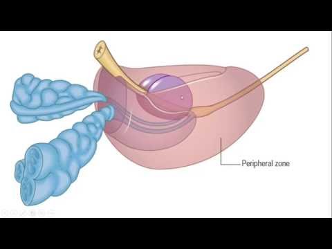 Mi prostate score( mips)