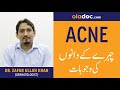 What Is The Cause Of Acne Ki Wajuhat Urdu Hindi Chehra Pe Dane Kyun Nikalte Hain Pimples Acne Scars