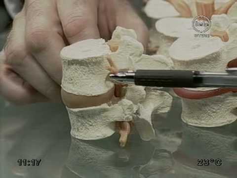 Biocurrents trattamento per la schiena Joint anatomia umana