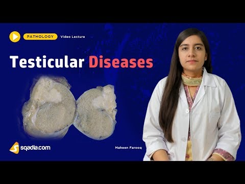 Prostatitis és szteroidok