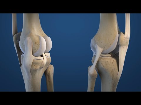 MediFacts - Knie