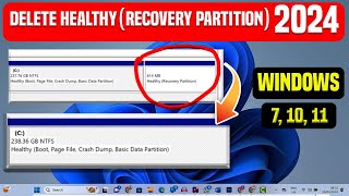 How To Delete Healthy / Recovery Partition Windows 10 /11 / 7 delete recovery partition in windows
