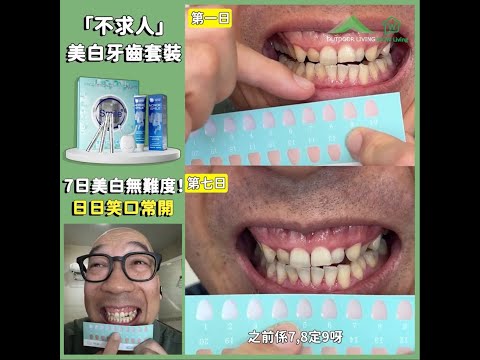 【「不求人」🦷New Smile美白牙齒套裝🪥，有時啲牙黃咁咁，笑起上黎真係好尷尬！🤐】
