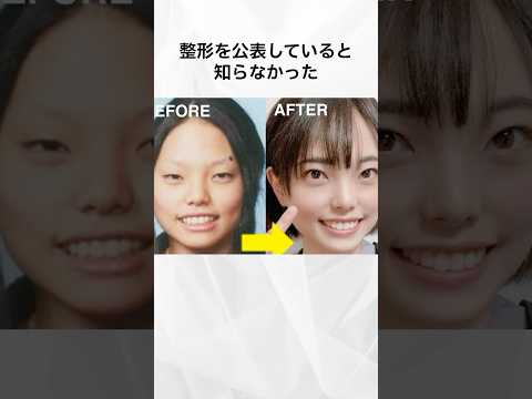 整形を公表していると知らなかった女性芸能人まとめ#shorts #芸能人 #整形