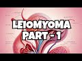 84 Leiomyoma Part 1 Obstetrics Gynecology For USMLE Step 2 CK Pathogenesis Types