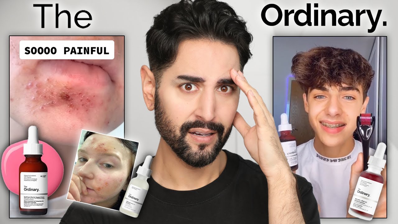 Are The Ordinary's Products Actually Dangerous? The Truth About The Chemical Burn Claims