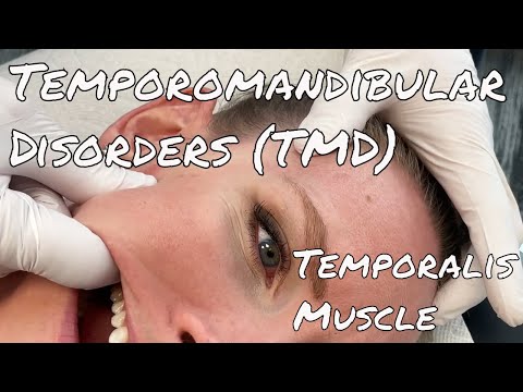 TMJ Pain - Temporalis Release - Motion Specific Release
