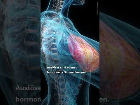 Causes of breast lumps #shorts