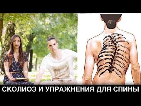 Сколиоз 2 17 градусов Корректор осанки пояснично-грудного отдела