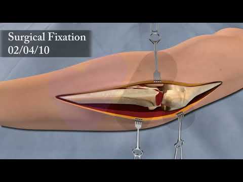 Medical Animation