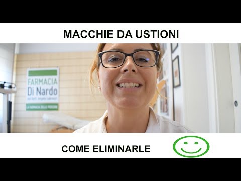 Lentiggini Yaroslavl sito ufficiale Leliminazione di pigmentary nota la gravidanza