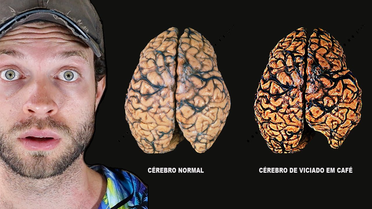 Os Impressionantes Efeitos Do Café No Seu Corpo