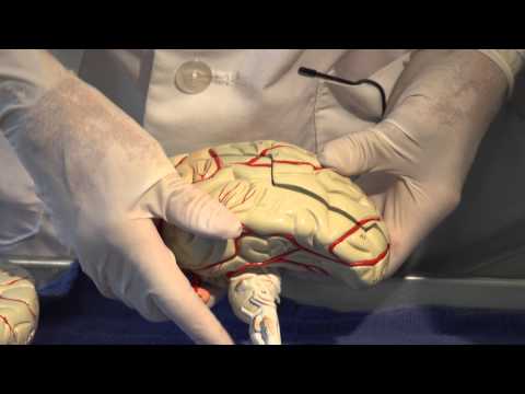 Cerebral Circulation: Neuroanatomy Video Lab - Brain Dissections